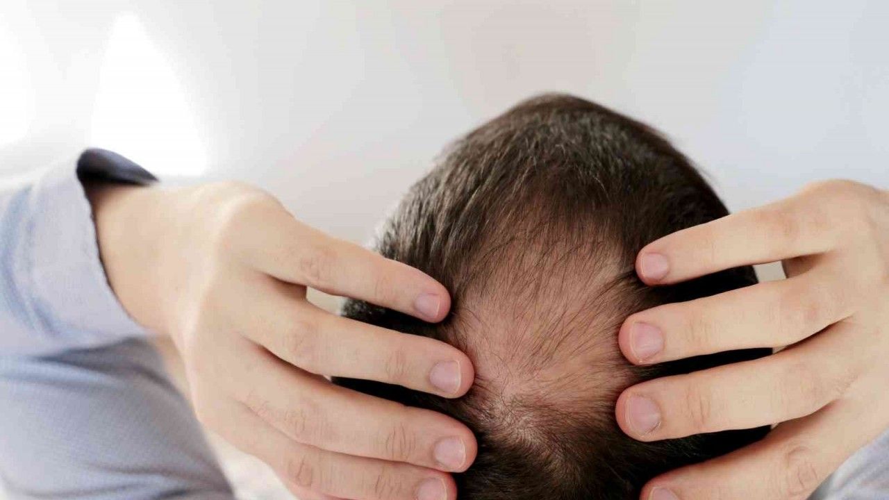 Kök hücre tedavisi ile saç dökülmesini durdurun
