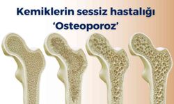 Kemiklerin sessiz hastalığı ‘osteoporoz’