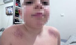 Oğlunu darbettiğini iddia ettiği öğretmenden şikayetçi oldu