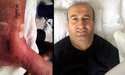 Arkeolojik kazı alanındaki çukura düşünce ayağında yüzde 3'lük engel oluştu