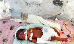 Antalya'da 650 gram doğan 'Leyloş bebek' hayata tutundu