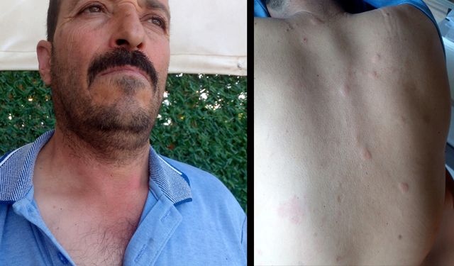 Gazipaşa'da ayının elinden dakika farkıyla kurtuldu