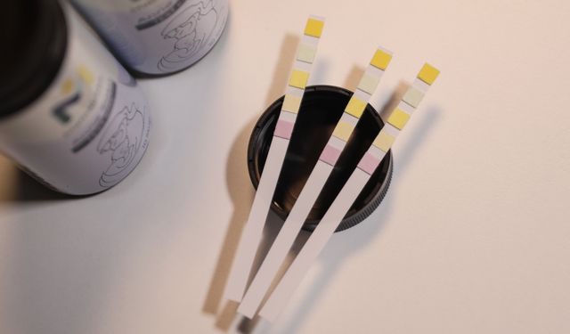 Dünyada 5 parametre bakılabilen tek testle anne sütünün değerleri ölçülüyor