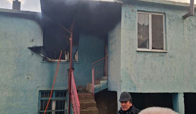 Manavgat'ta yangında yaralandı, hastanede kurtarılamadı