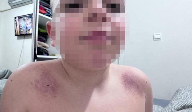 Oğlunu darbettiğini iddia ettiği öğretmenden şikayetçi oldu