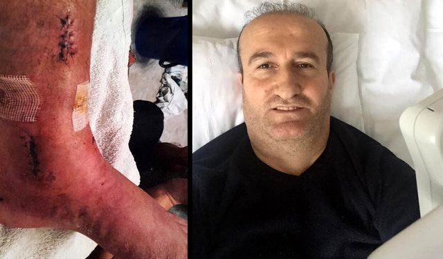 Arkeolojik kazı alanındaki çukura düşünce ayağında yüzde 3'lük engel oluştu