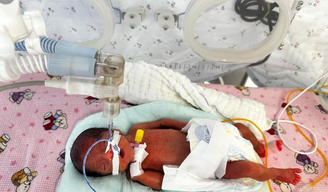 Antalya'da 650 gram doğan 'Leyloş bebek' hayata tutundu