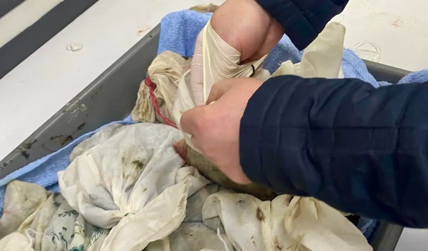 Havalimanında kaçak sülük operasyonu... 90 bin canlı tıbbi sülük ele geçirildi