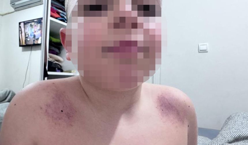 Oğlunu darbettiğini iddia ettiği öğretmenden şikayetçi oldu