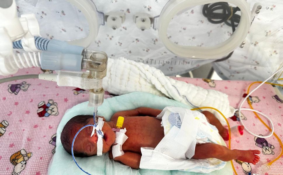 Antalya'da 650 gram doğan 'Leyloş bebek' hayata tutundu